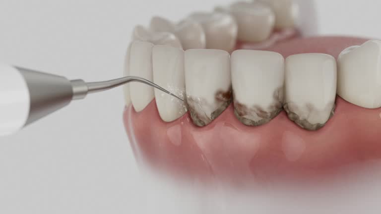 Trusted Root Canal Treatment service in Grosse Pointe, MI - Dentist Open Now